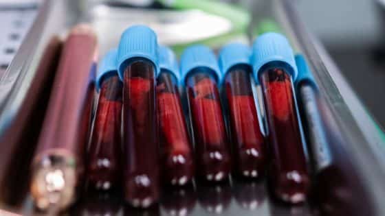 العد الدموي الشامل” .. اختبار الدم الأكثر شيوعا الذي يخبرك الكثير عن صحتك | صحة وبيئة “صدى الخبر