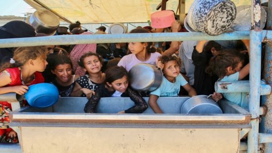 واحد من كل 5 أطفال في غزة يعاني سوء التغذية “صدى الخبر”