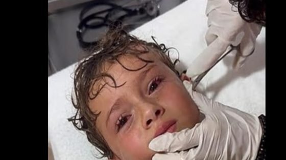 استخراج سلطعون من أذن طفل “صدى الخبر”